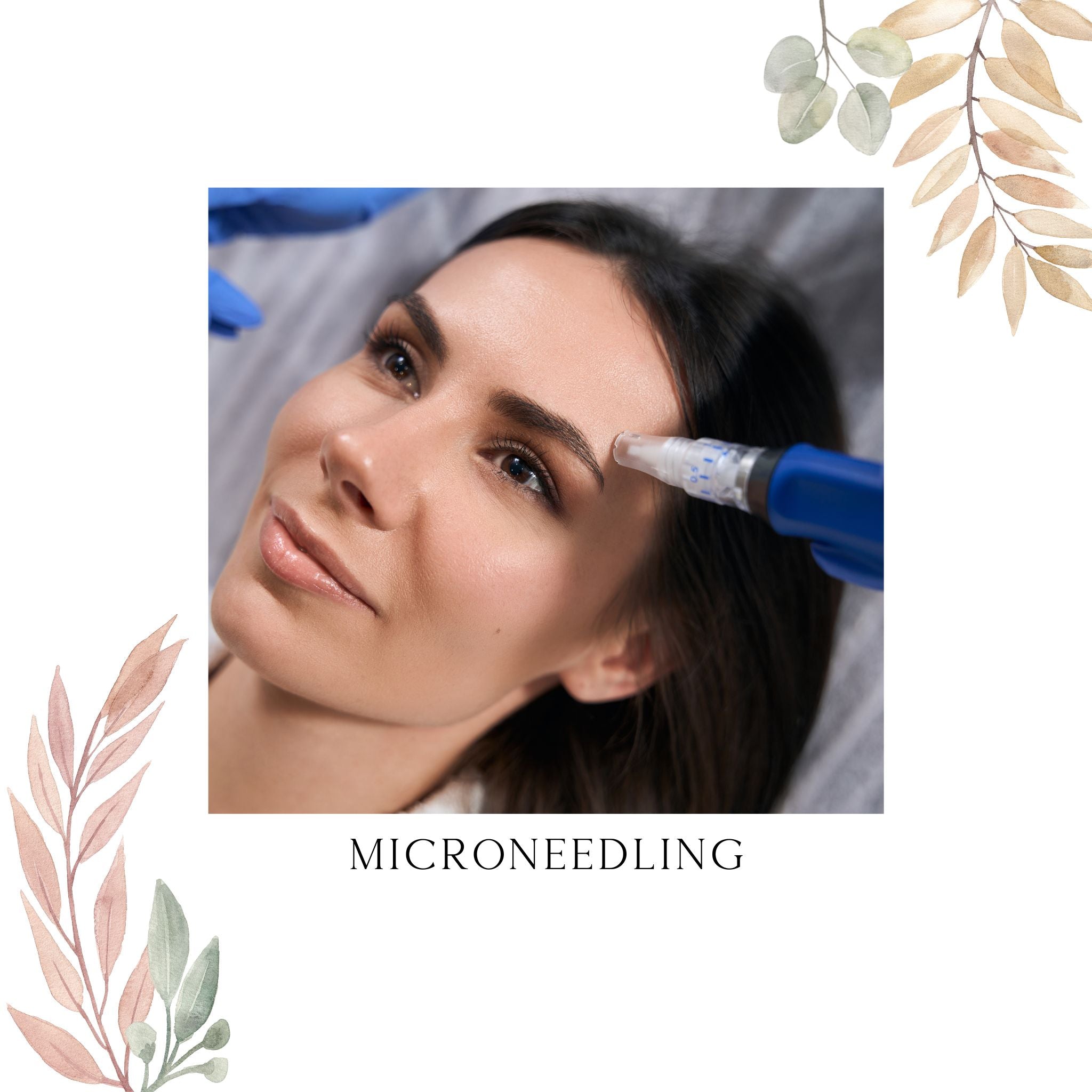 Microneedling