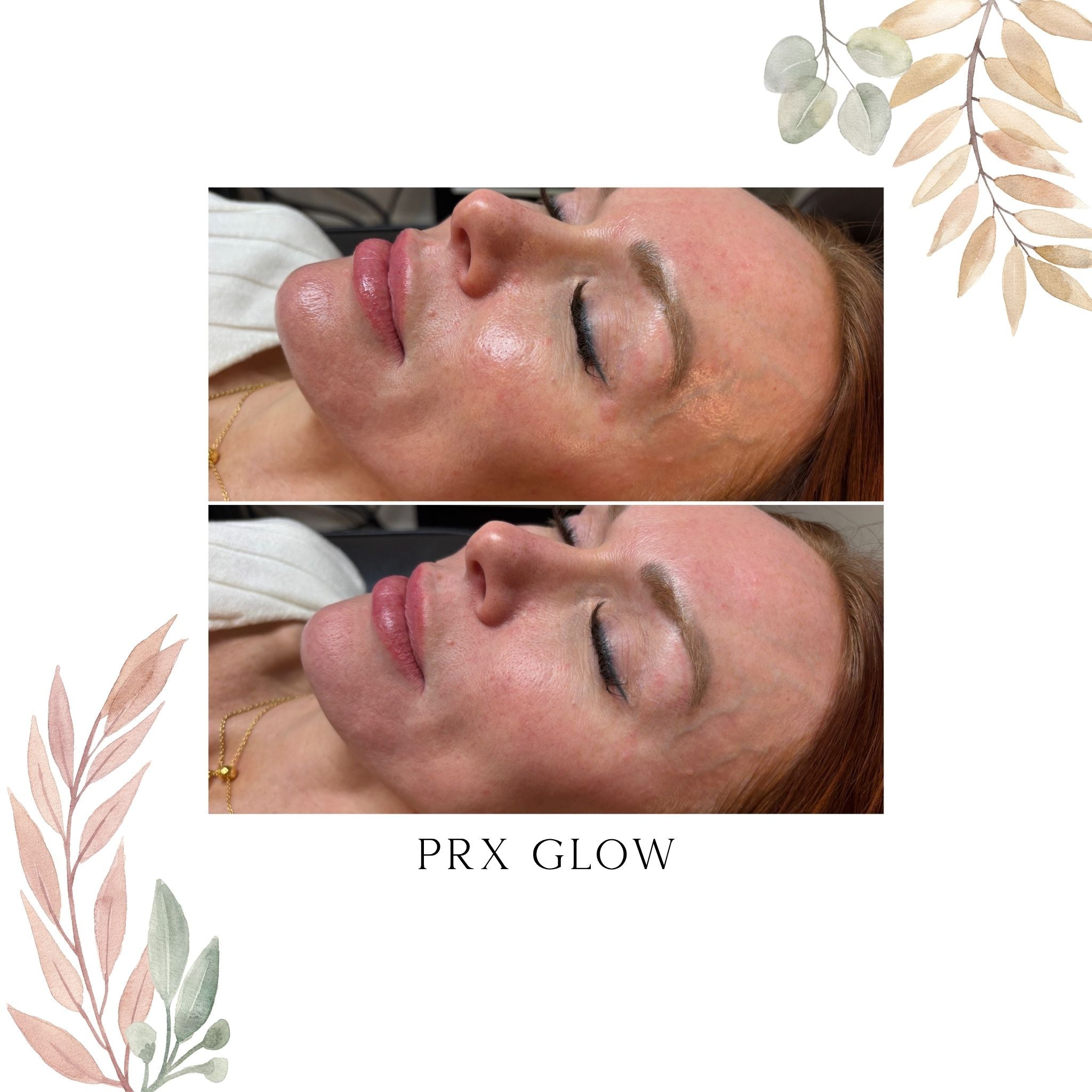 PRX Glow