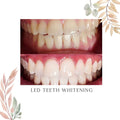 LED Teeth Whitening