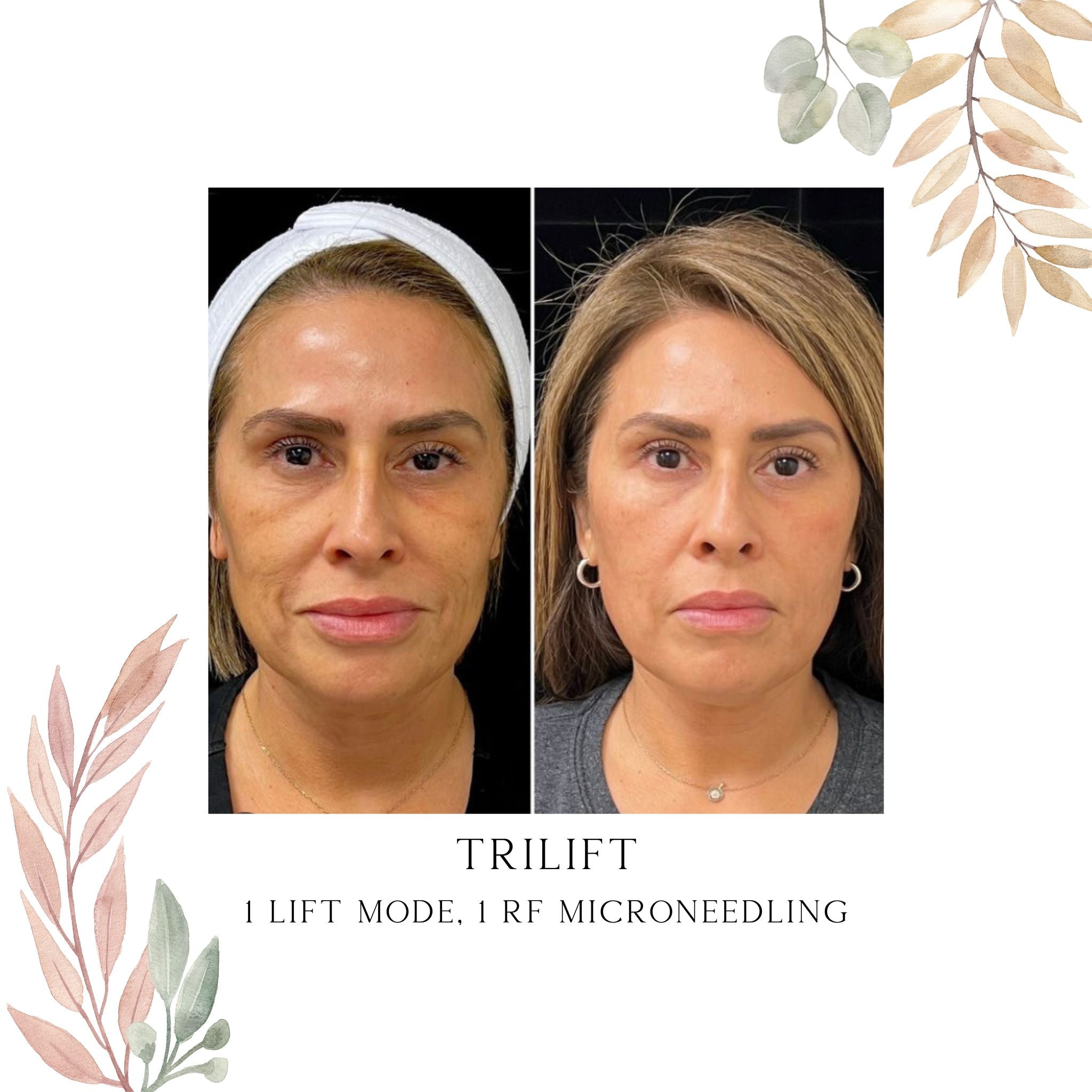 triLift Services (Click to see options)