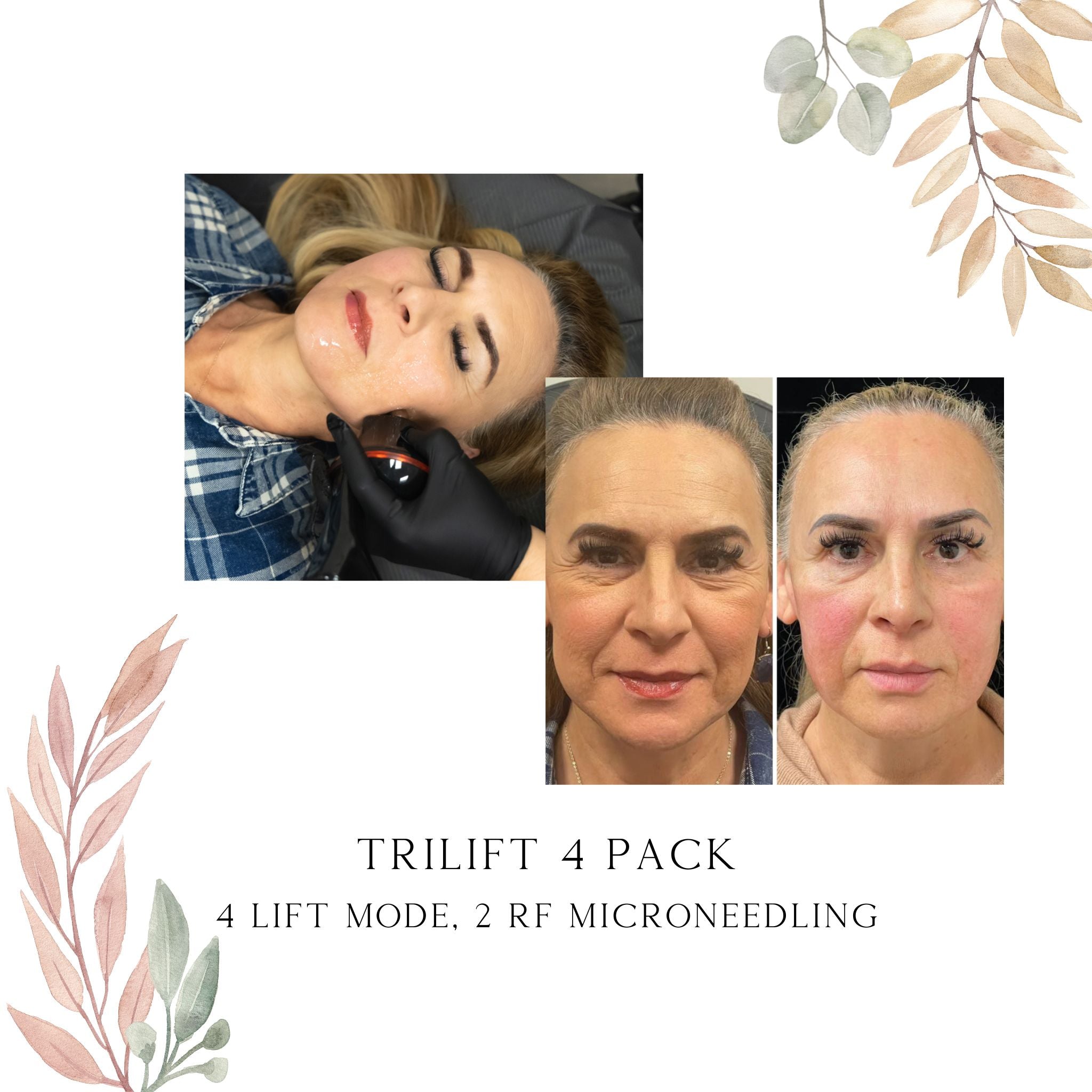 triLift Services (Click to see options)