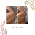 Lift & Glow (Click to see options)