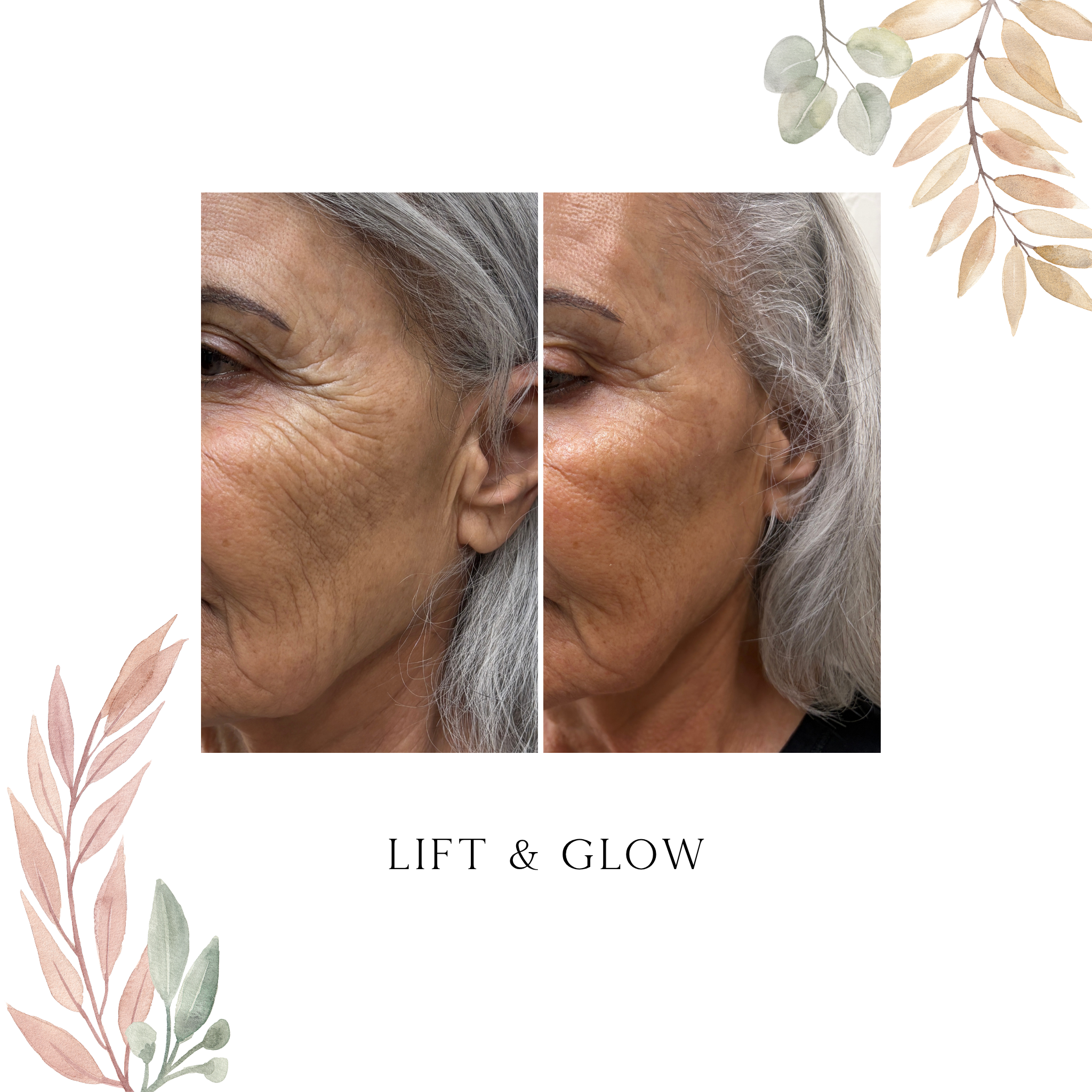 Lift & Glow (Click to see options)