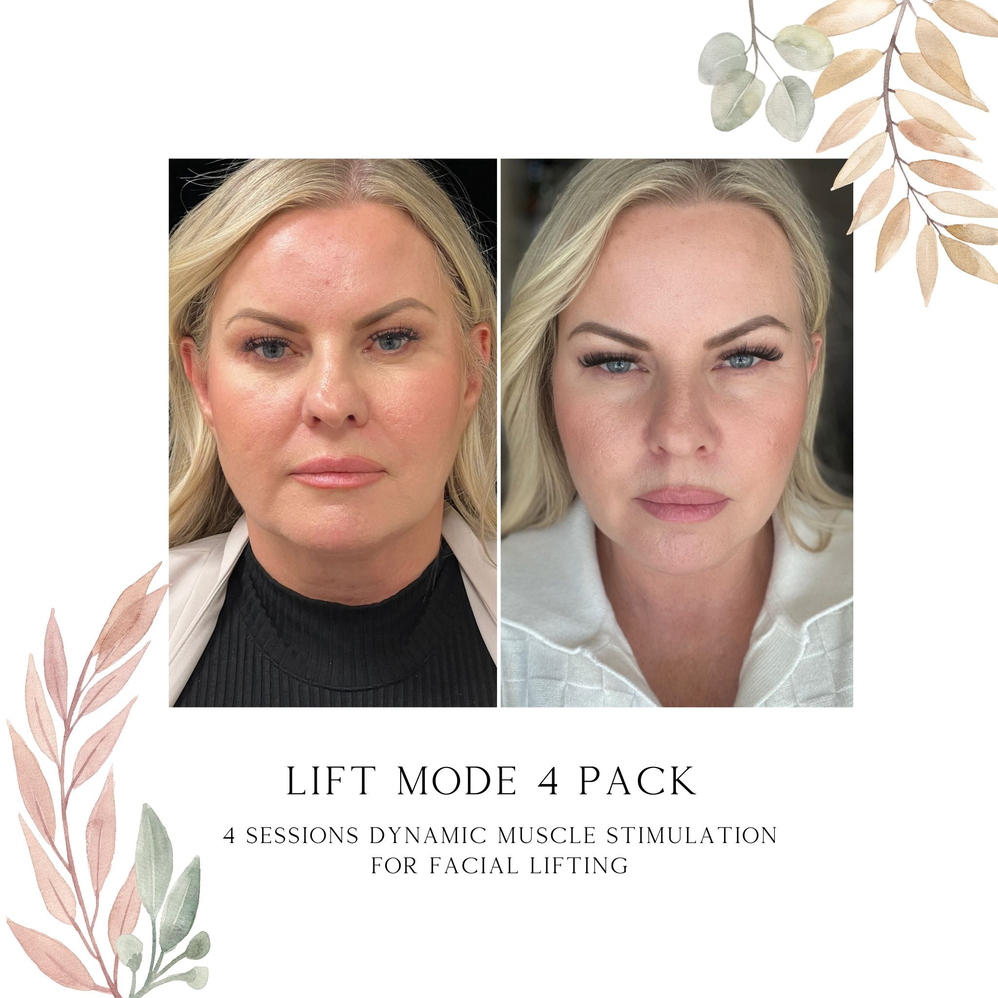 triLift Services (Click to see options)