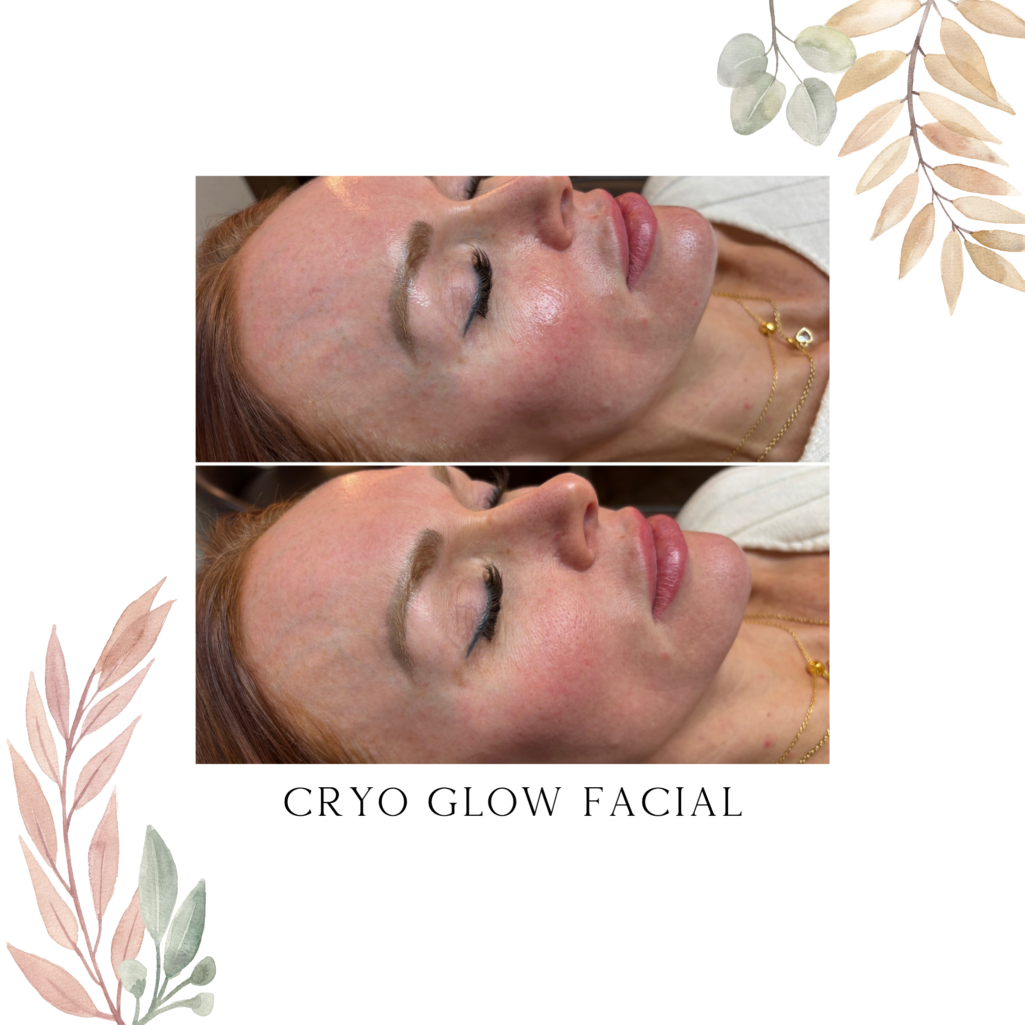 Cryo Glow Facial