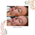 PRX Glow Services (Click to see options)